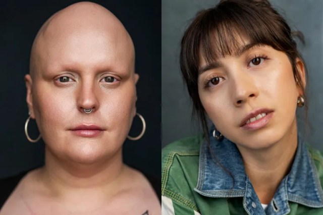 Sam Buttery and Miracle Chance