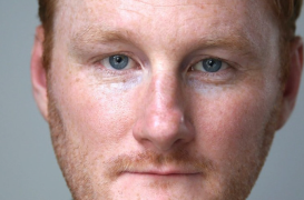 Close-up portrait of a man with red hair and blue eyes, neutral expression.